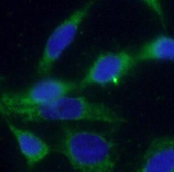 YTHDC2 Rabbit Polyclonal Antibody