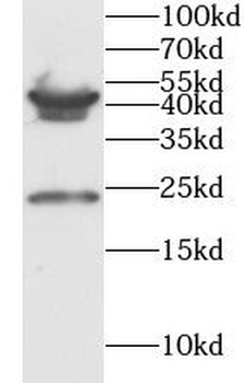 PMCH Rabbit Polyclonal Antibody