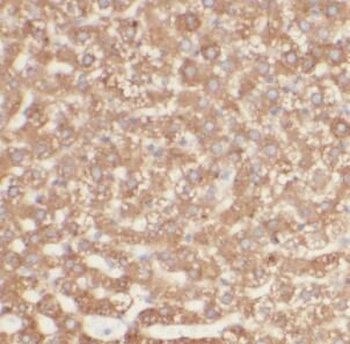 PIEZO2 Rabbit Polyclonal Antibody