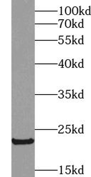 IFNB1 Rabbit Polyclonal Antibody