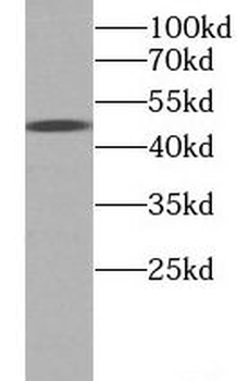 NCR1 Rabbit Polyclonal Antibody