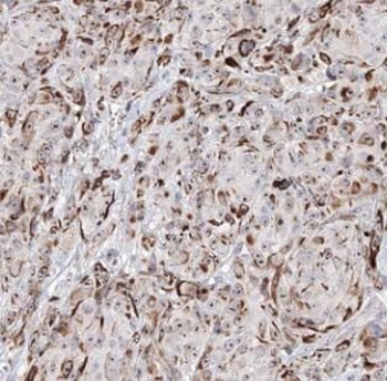 NCR1 Rabbit Polyclonal Antibody