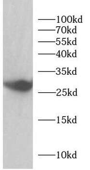GSTO1 Rabbit Polyclonal Antibody