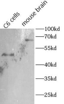 CHAT Rabbit Polyclonal Antibody