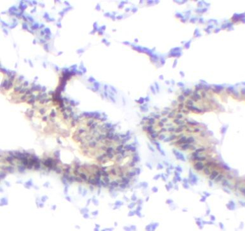 CHAT Rabbit Polyclonal Antibody