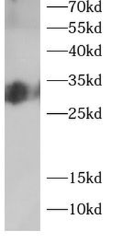 CTHRC1 Rabbit Polyclonal Antibody