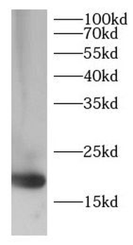 EIF5A Rabbit Polyclonal Antibody