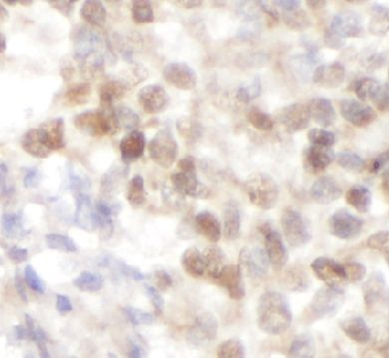NOP58 Rabbit Polyclonal Antibody