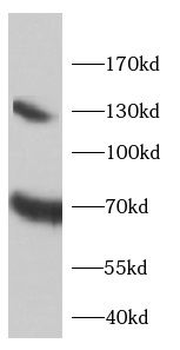 SLC1A2 Rabbit Polyclonal Antibody
