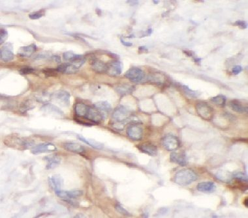 SLC1A2 Rabbit Polyclonal Antibody