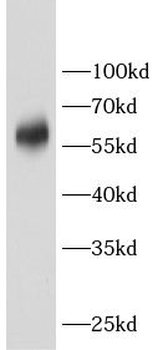CRAT Rabbit Polyclonal Antibody