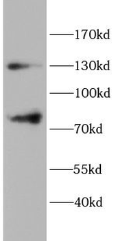 FZD3 Rabbit Polyclonal Antibody