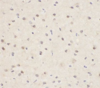 Aβ42 Rabbit Polyclonal Antibody