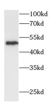 DDX25 Rabbit Polyclonal Antibody