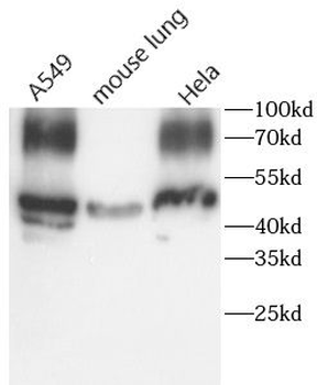 PTGS2 Rabbit Polyclonal Antibody