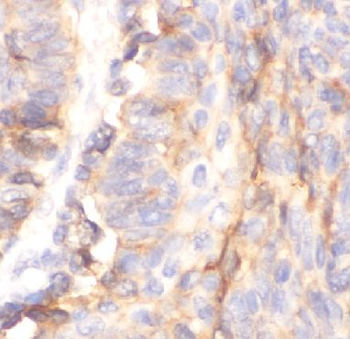 PTGS2 Rabbit Polyclonal Antibody