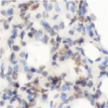 AGER Antibody