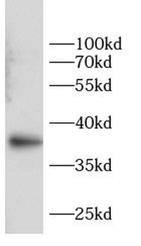 ANXA2 Rabbit Polyclonal Antibody
