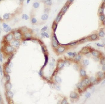 ANXA2 Rabbit Polyclonal Antibody