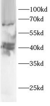 ARL13B Rabbit Polyclonal Antibody