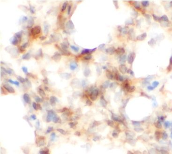 AREG Rabbit Polyclonal Antibody