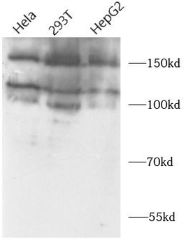 TIMELESS Rabbit Polyclonal Antibody