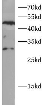 NAT2 Rabbit Polyclonal Antibody