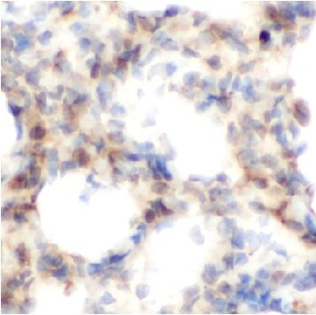 NAT2 Rabbit Polyclonal Antibody