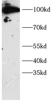 DTL Rabbit Polyclonal Antibody