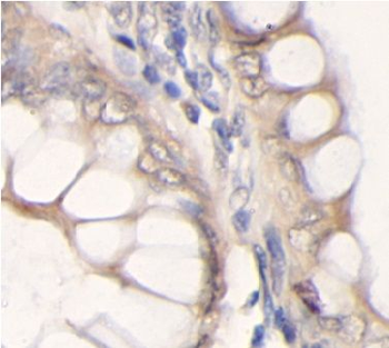 DTL Rabbit Polyclonal Antibody
