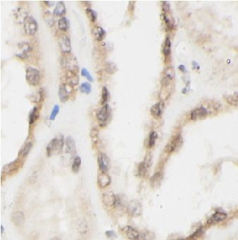 CD40LG Antibody