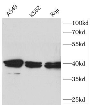 APTX Rabbit Polyclonal Antibody