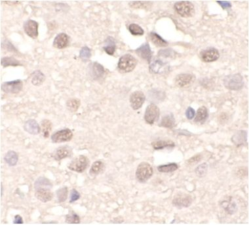 APTX Rabbit Polyclonal Antibody