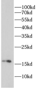 RHEB Rabbit Polyclonal Antibody