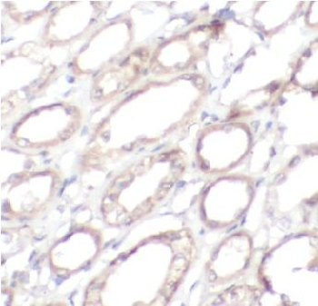 RHEB Rabbit Polyclonal Antibody