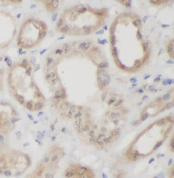 VNN1 Rabbit Polyclonal Antibody