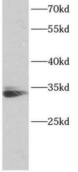 TNFRSF6B Antibody