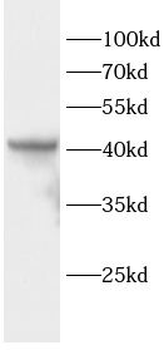 CSNK2A1 Rabbit Polyclonal Antibody