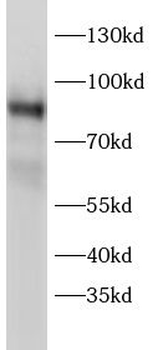 PRKCH Rabbit Polyclonal Antibody