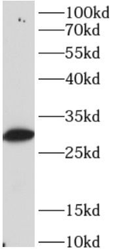 PPP1CB Rabbit Polyclonal Antibody