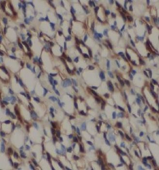 PPP1CB Rabbit Polyclonal Antibody