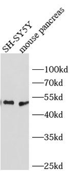 INSM1 Rabbit Polyclonal Antibody