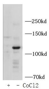 EPAS1 Antibody