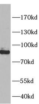 SLC26A3 Rabbit Polyclonal Antibody