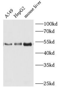 HGF Rabbit Polyclonal Antibody