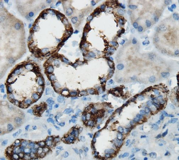 HGF Rabbit Polyclonal Antibody