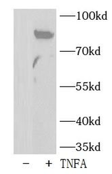 Phospho IKKα/β (S176/180) Rabbit Polyclonal Antibody