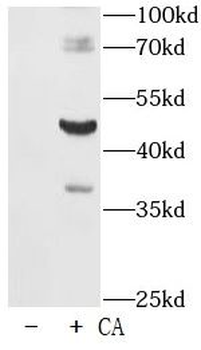 Phospho Tau (T181) Rabbit Polyclonal Antibody