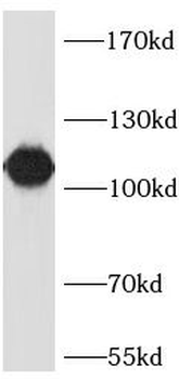 LAMP1 Mouse Monoclonal Antibody