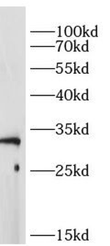 VSIG4 Antibody